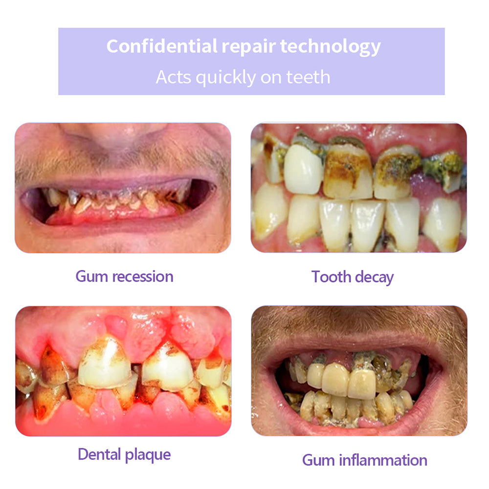 ✨Official Brand Store ✨: QIAWI™ Teeth Restoration Mineral Powder🦷