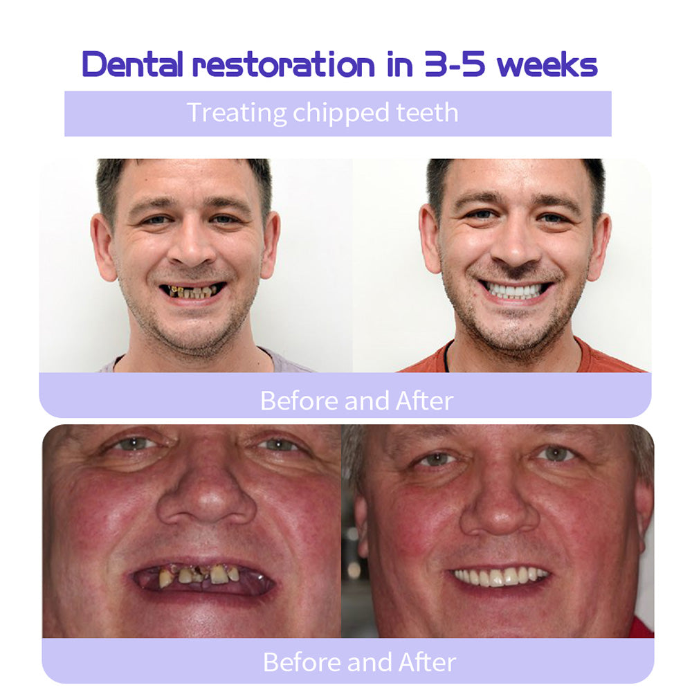 ✨Official Brand Store ✨: QIAWI™ Teeth Restoration Mineral Powder🦷