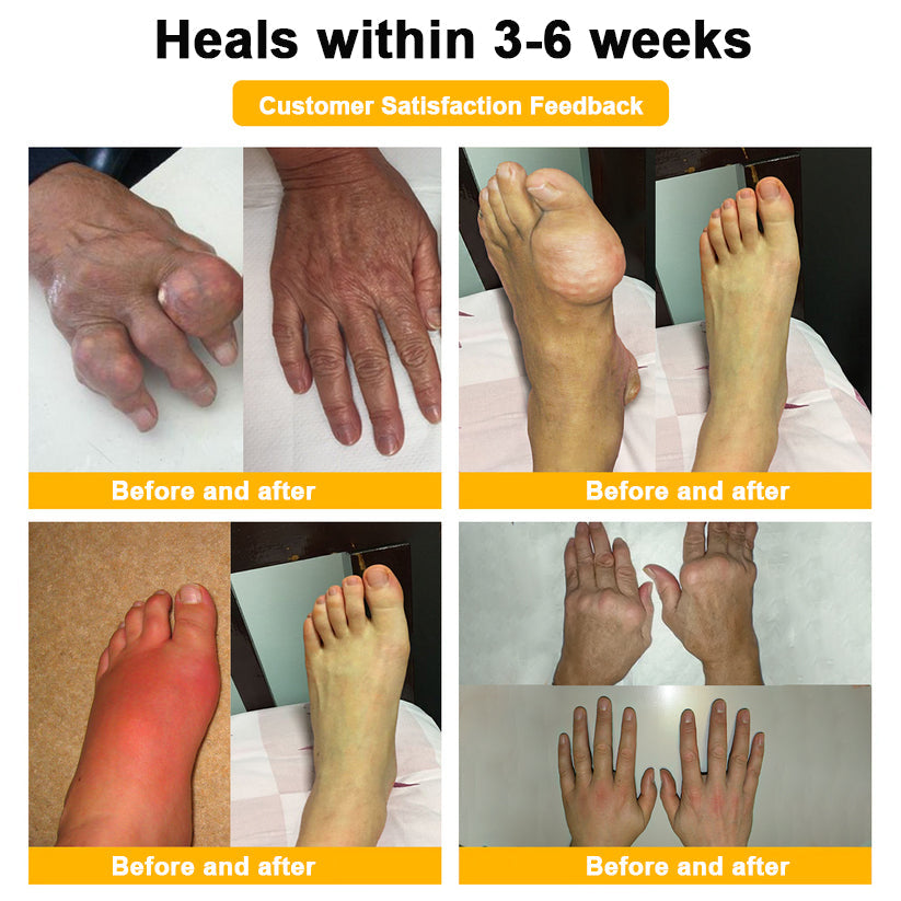 🔥Time-Limited Offer - AQA™ Bee Venom Pain Relief Bone Soothing Cream🐝
