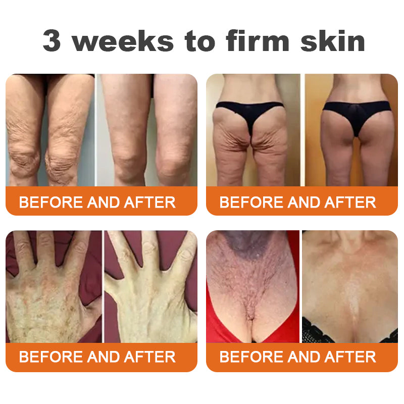 Made and Shipped from USA👨⚕️HZA™ AH-8 Age-defying Firming Cream(🔥LAST DAY 70% OFF)💄