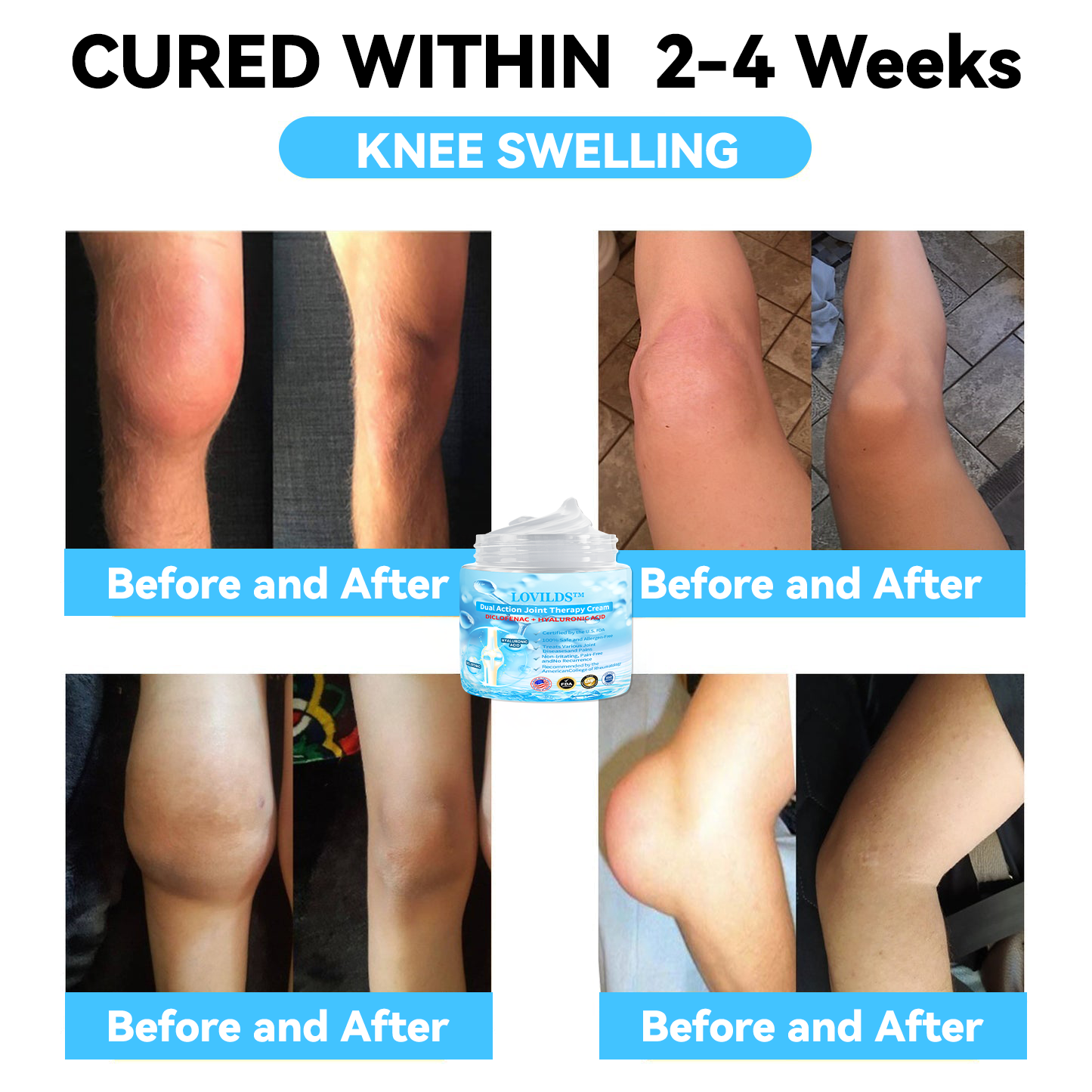 LOVILDS™ Joint & Bone Therapy Cream
