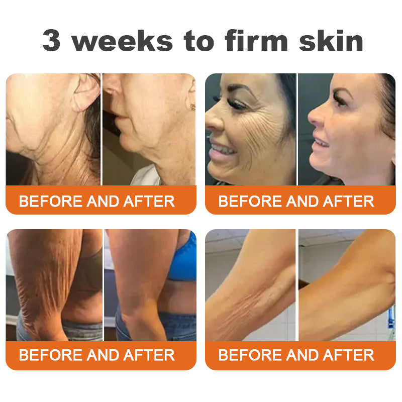 Made and Shipped from USA👨⚕️HZA™ AH-8 Age-defying Firming Cream(🔥LAST DAY 70% OFF)💄