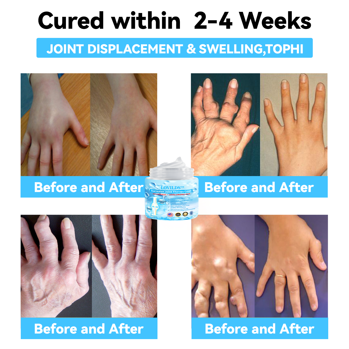 LOVILDS™ Joint & Bone Therapy Cream
