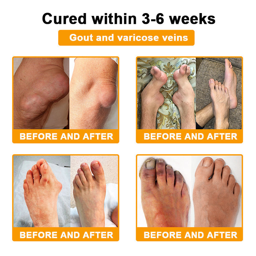 🔥Time-Limited Offer - AQA™ Bee Venom Pain Relief Bone Soothing Cream🐝