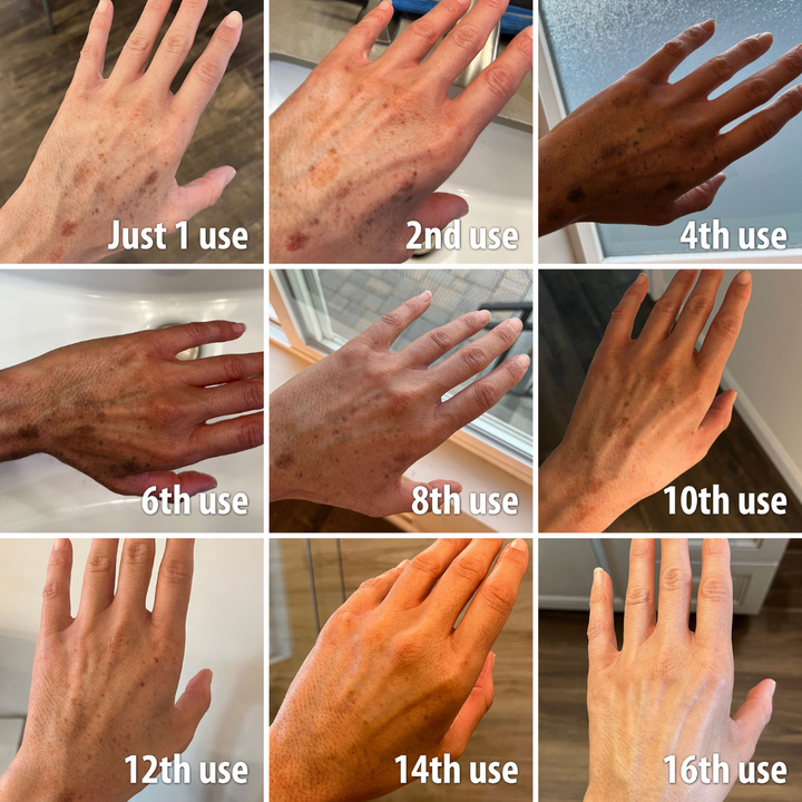 (🔥LAST DAY SALE-80% OFF)Fast Dark Spot Remover-AQA™ Melanin Correcting Facial Serum