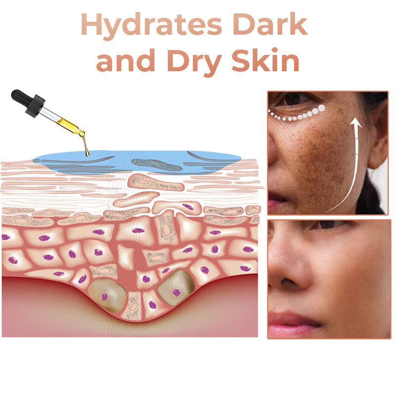 (🔥LAST DAY SALE-80% OFF)Fast Dark Spot Remover-AQA™ Melanin Correcting Facial Serum