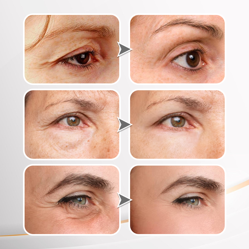 🔥【Official Brand Store】Instant FIRMx Temporary Face Tightener– 80% OFF!