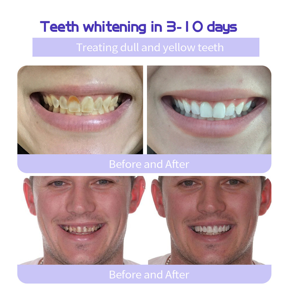 ✨Official Brand Store ✨: QIAWI™ Teeth Restoration Mineral Powder🦷