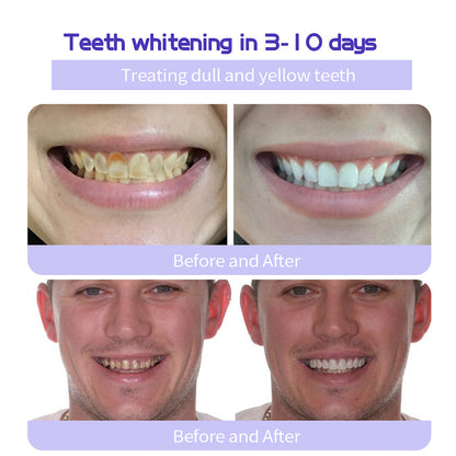 ✨Official Brand Store ✨: QIAWI™ Teeth Restoration Mineral Powder🦷