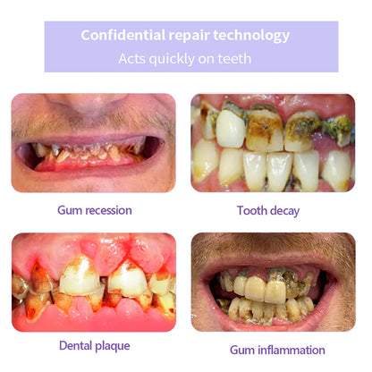 ✨Official Brand Store ✨: QIAWI™ Teeth Restoration Mineral Powder🦷