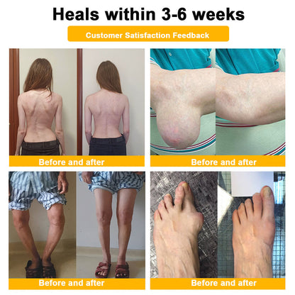 🔥Time-Limited Offer - AQA™ Bee Venom Pain Relief Bone Soothing Cream🐝