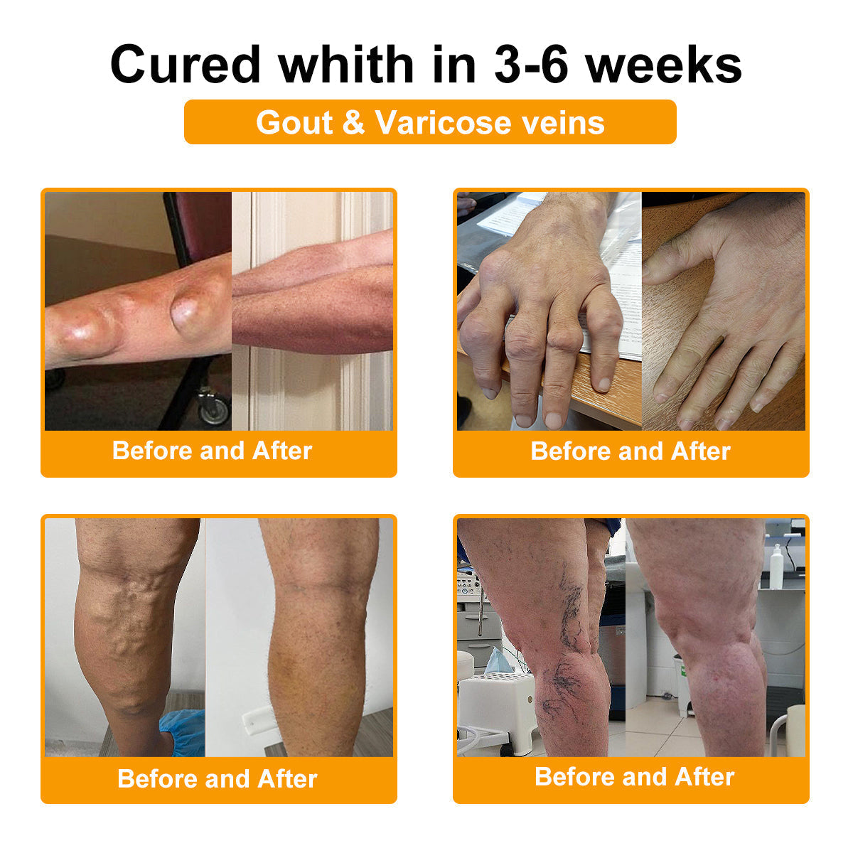 🔥Time-Limited Offer - AQA™ Bee Venom Pain Relief Bone Soothing Cream🐝