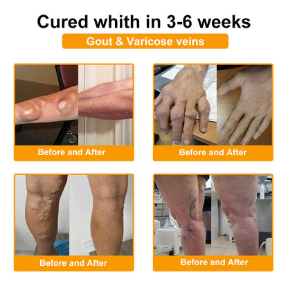 🔥Time-Limited Offer - AQA™ Bee Venom Pain Relief Bone Soothing Cream🐝