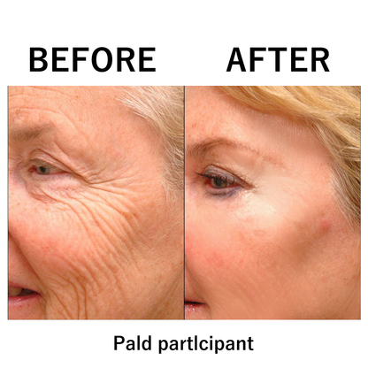 🔥【Official Brand Store】Instant FIRMx Temporary Face Tightener– 79% OFF!