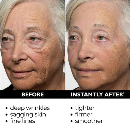 🔥【Official Brand Store】Instant FIRMx Temporary Face Tightener– 79% OFF!