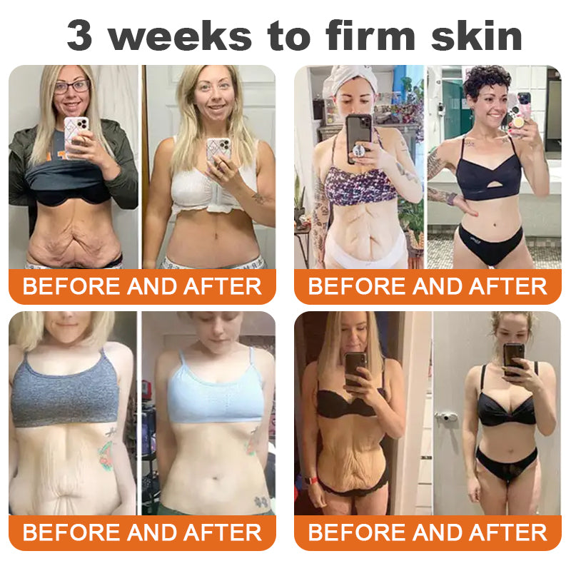 Made and Shipped from USA👨‍⚕️HZA™ AH-8 Age-defying Firming Cream(🔥LAST DAY 70% OFF)💄