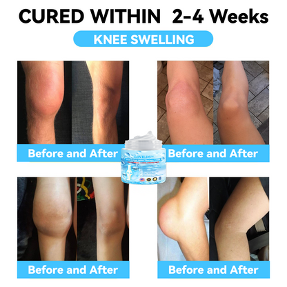 LOVILDS™ Joint & Bone Therapy Cream