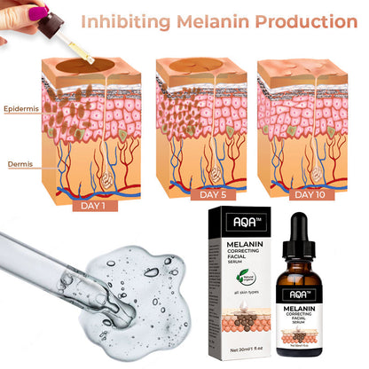 （🔥LAST DAY SALE-80% OFF)Fast Dark Spot Remover-AQA™ Melanin Correcting Facial Serum