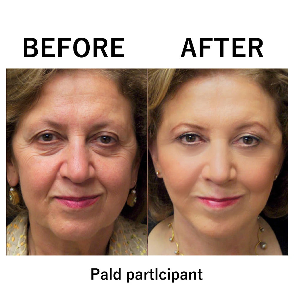 🔥【Official Brand Store】Instant FIRMx Temporary Face Tightener– 79% OFF!