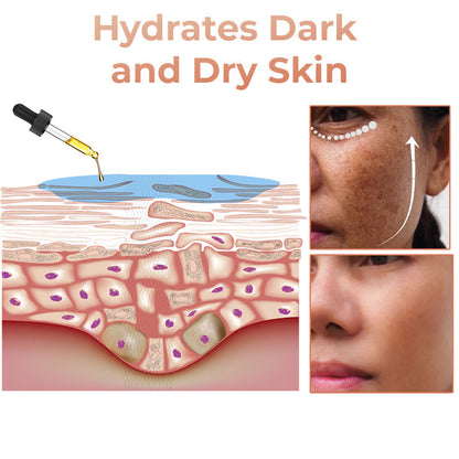 （🔥LAST DAY SALE-80% OFF)Fast Dark Spot Remover-AQA™ Melanin Correcting Facial Serum